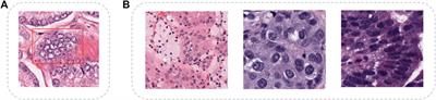Contextual Mixing Feature Unet for Multi-Organ Nuclei Segmentation